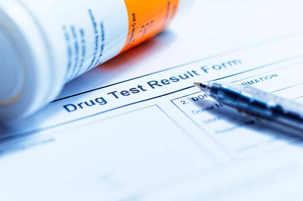 urine drug test to find out How Long Does Fentanyl Stay in Your System?